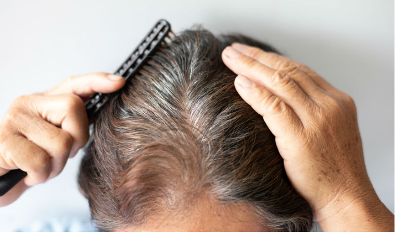 Solutions For Hair Thinning
